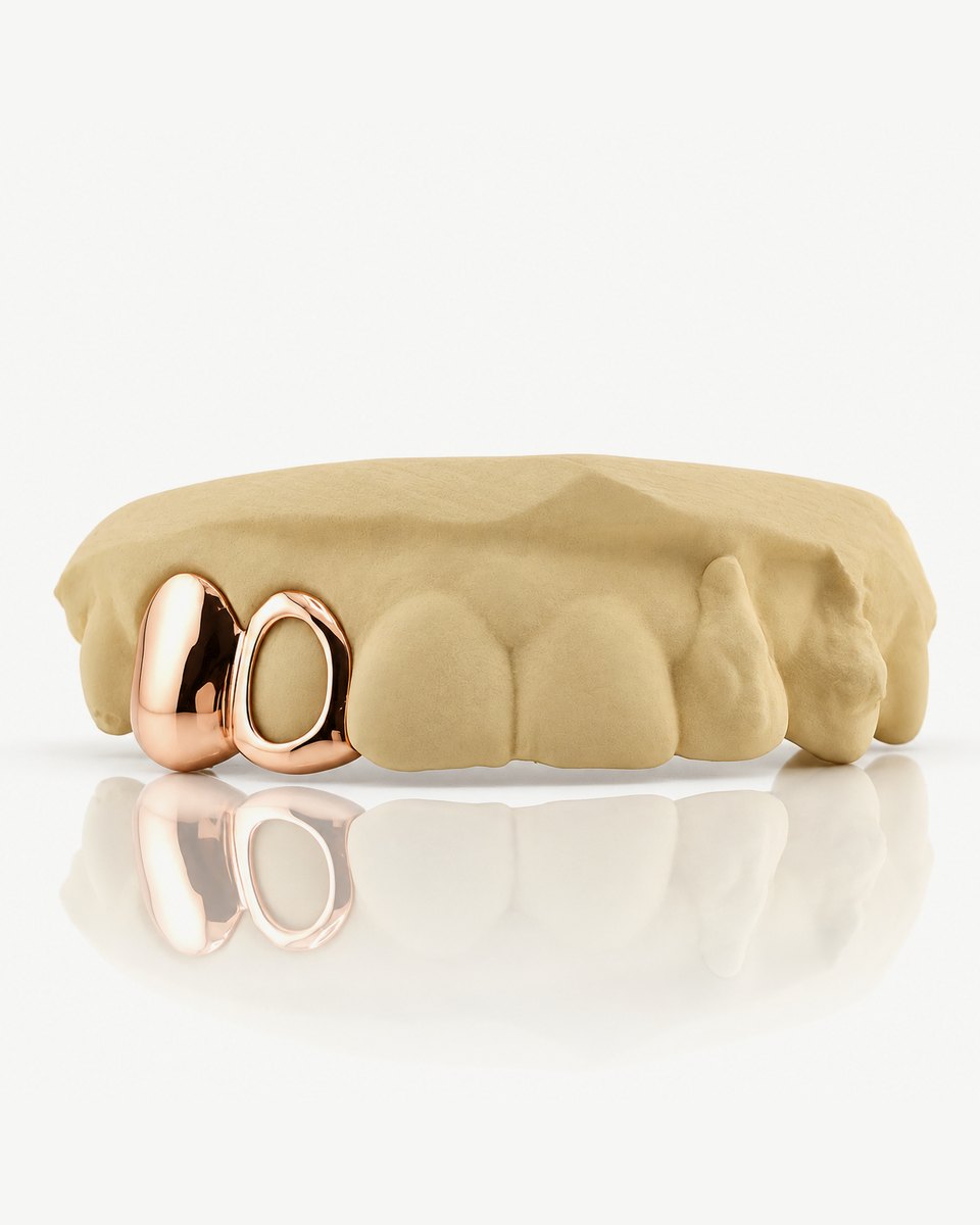 Bộ grillz 2 răng bằng bạc 925 mạ vàng hồng, một răng bọc kín và một răng viền hở, gắn trên mẫu răng